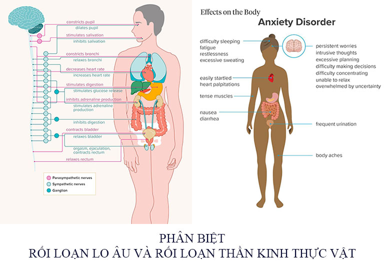 Phân biệt rối loạn lo âu và rối loạn thần kinh thực vật Phân biệt rối loạn lo âu và rối loạn thần kinh thực vật