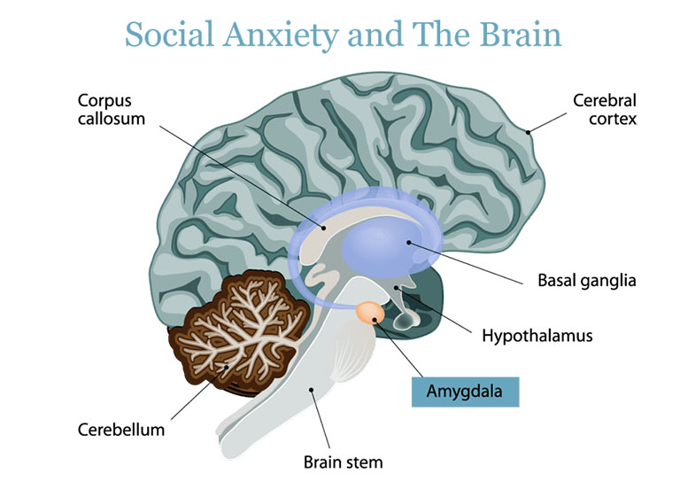 dấu hiệu ám ảnh sợ xã hội Social Anxiety Disorder là gì?