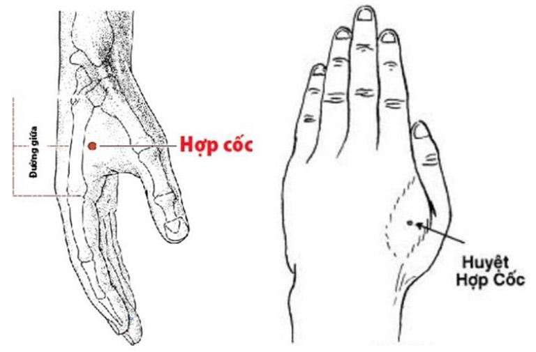 bấm huyệt chữa rối loạn lo âu bấm huyệt chữa rối loạn lo âu
