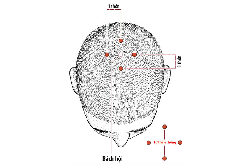 Cách bấm huyệt giảm stress Cách bấm huyệt giảm stress