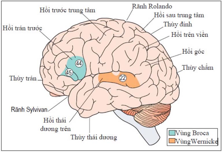 rối loạn ngôn ngữ sau tai biến rối loạn ngôn ngữ sau tai biến