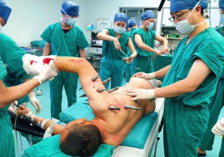 Chứng sợ vật nhọn