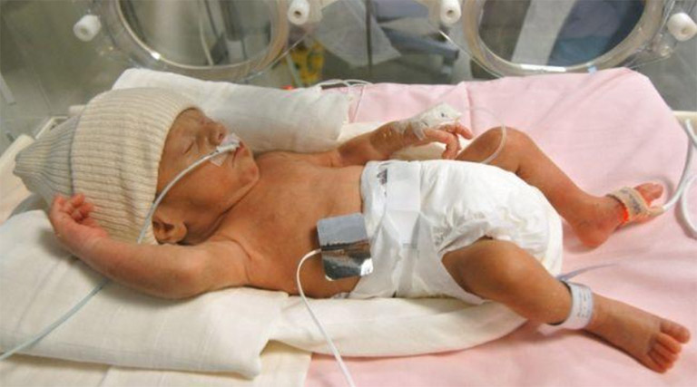 Trẻ chậm phát triển trí tuệ