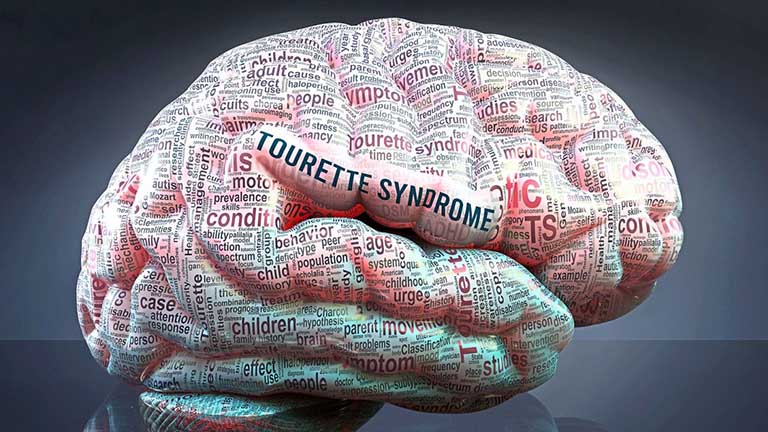 hội chứng Tourette